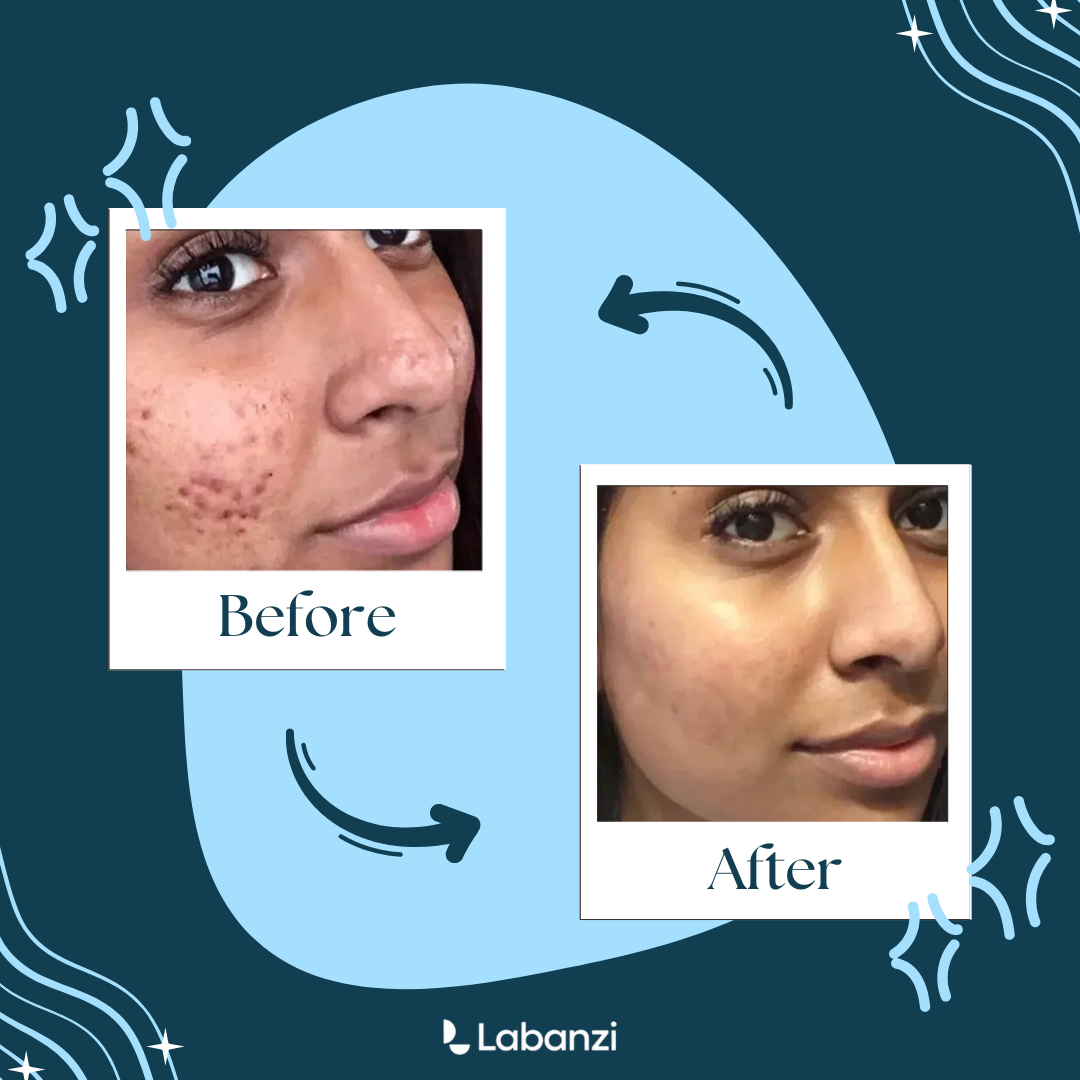 Face Brightening Kojic Acid Retinol Cream