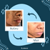 Face Brightening Kojic Acid Retinol Cream