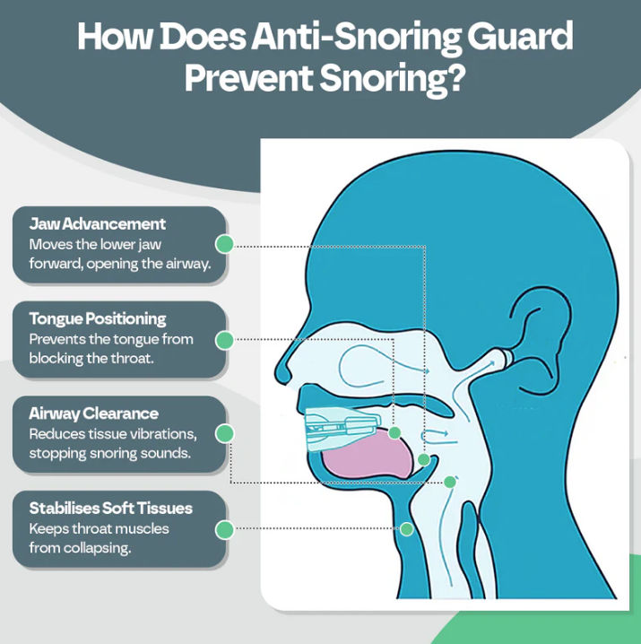 Anti Snoring Bruxism Mouth Guard
